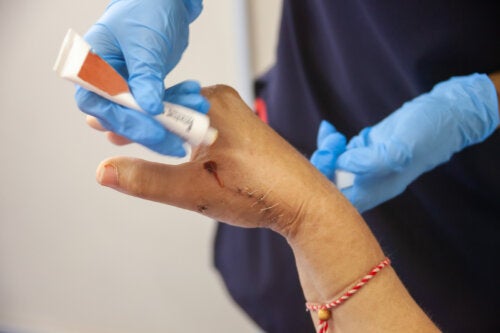 Types de crèmes et onguents cicatrisants les plus utilisés