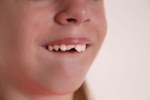Coup sur les dents de lait : que faire ?