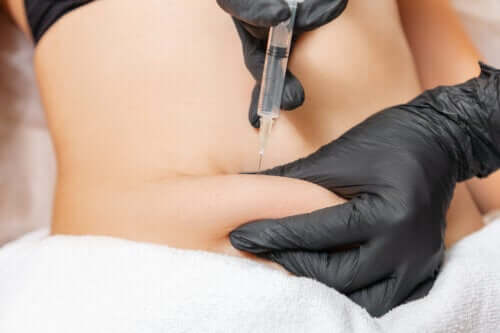 7 traitements pour lutter contre la flaccidité abdominale