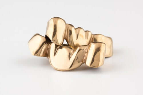 Grillz sur les dents : risques et précautions