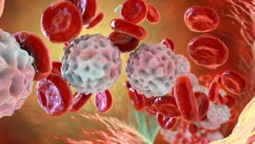 Lymphocytose ou taux élevé de lymphocytes : causes et traitement