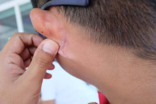Irritation derrière les oreilles : qu’est-ce qui peut en être la cause ?