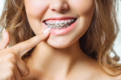 Extraction de molaire : est-elle nécessaire avant l'orthodontie ?