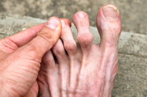 11 causes de douleur aux orteils