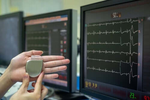 Qu’est-ce qu’un stimulateur cardiaque et comment fonctionne-t-il ?