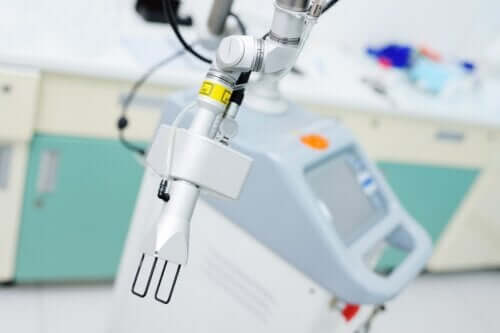 Ablation laser : en quoi consiste cette technique chirurgicale ?