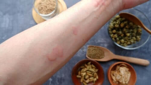 Allergie aux épices : comment savoir ?