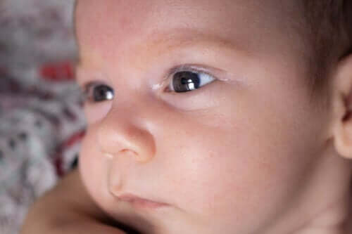 Aniridie ou absence d'iris : caractéristiques et causes