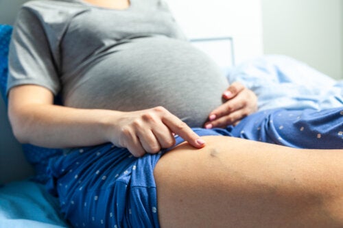 Phlébite pendant la grossesse: symptômes et traitement