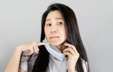 Maskné ou acné du masque : qu'est-ce que c'est et comment l'éviter ?
