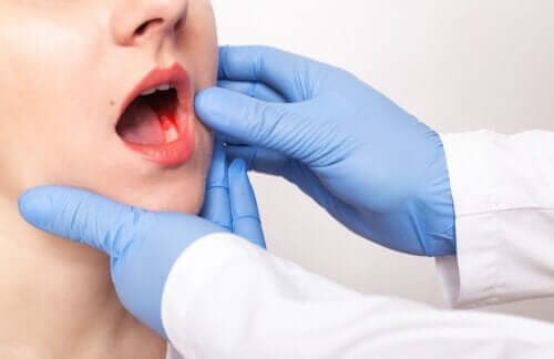 Les symptômes et les causes de la parodontite