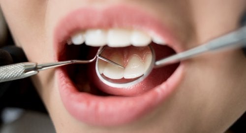 7 conséquences pour votre santé d'une mauvaise hygiène dentaire