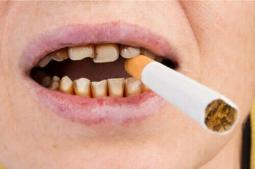 Comment le tabac affecte-t-il la santé dentaire ?
