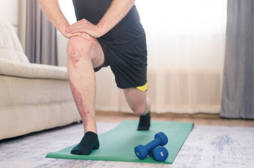 Avantages de l'exercice physique pour le psoriasis