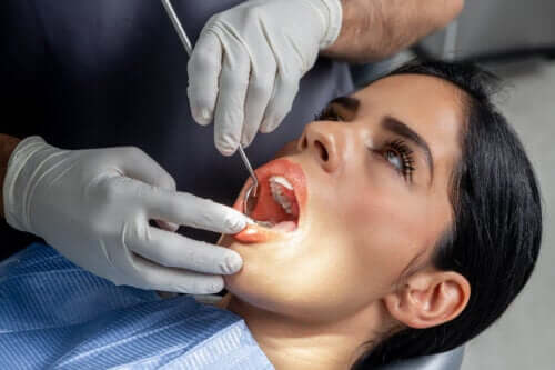 Mordançage à l’acide : quelle est cette procédure dentaire ?
