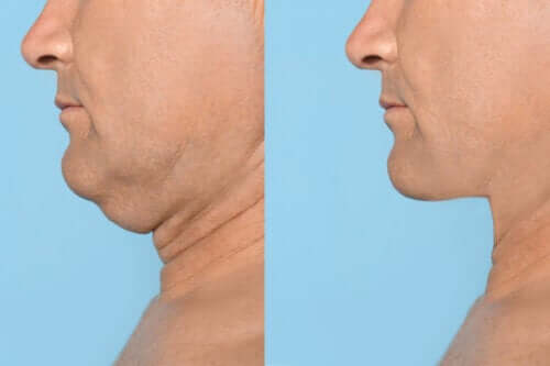 5 exercices pour avoir une mâchoire sculptée