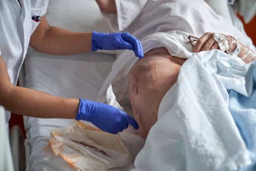 Qu'est-ce que l'ulcère terminal de Kennedy ?