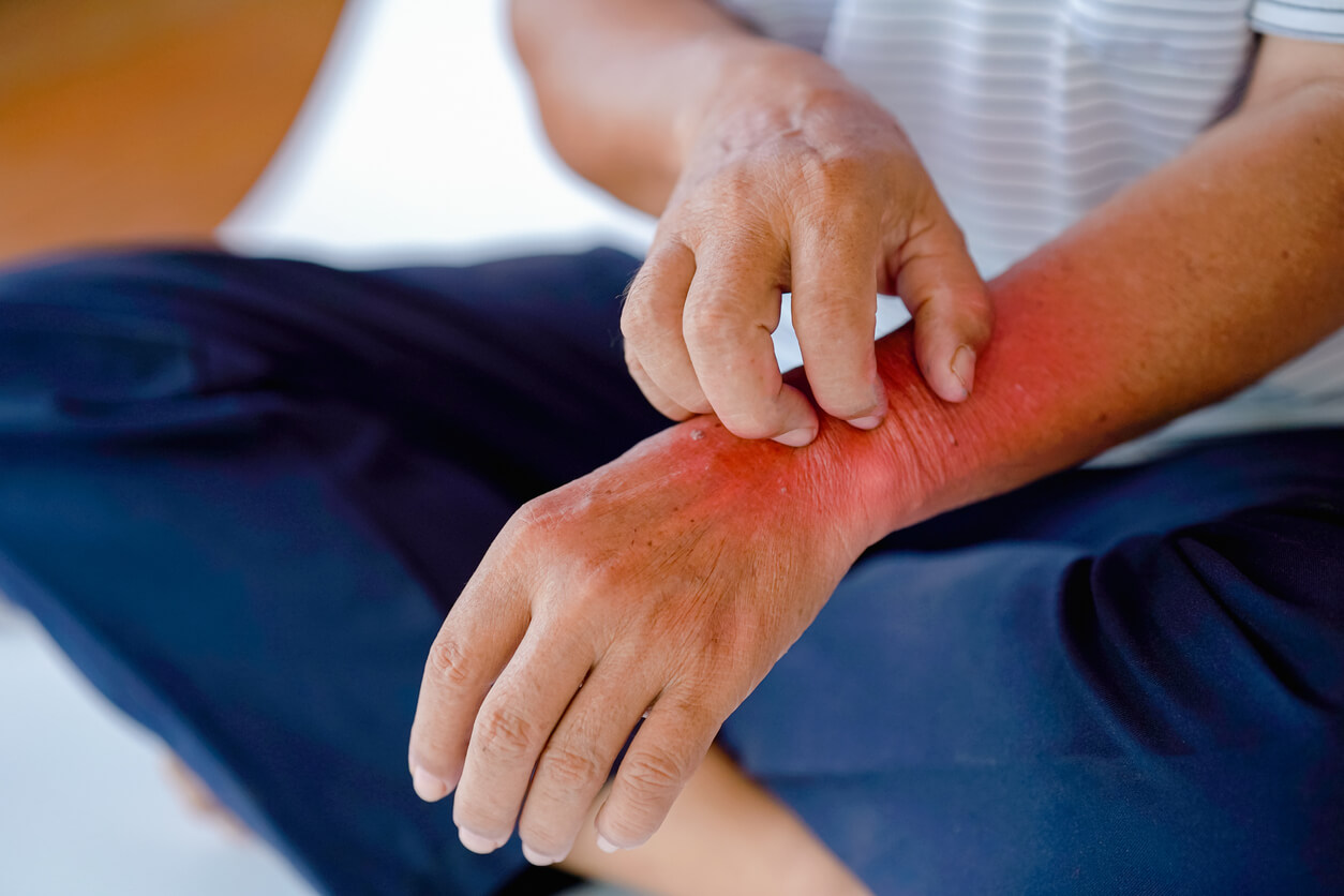 personne se grattant le poignet