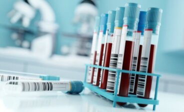 Qu'est-ce que le test GGT et que signifient les résultats ?