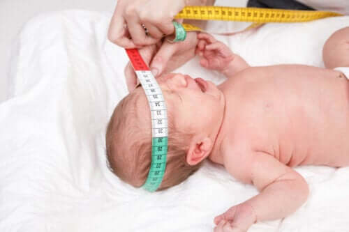 Craniosténose : causes, symptômes et traitements