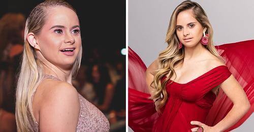 Promouvoir la beauté de l'inclusion : la première égérie Victoria's Secret atteint du syndrome de Down