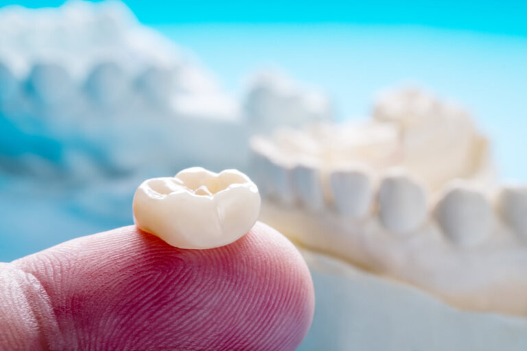 Couronnes dentaires: un traitement pour un sourire parfait