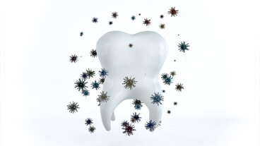 La gingivite est-elle contagieuse ? Comment la prévenir?