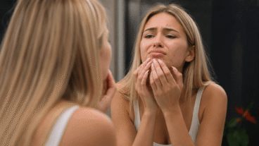 7 astuces pour camoufler un bouton avant un événement sans l'aggraver