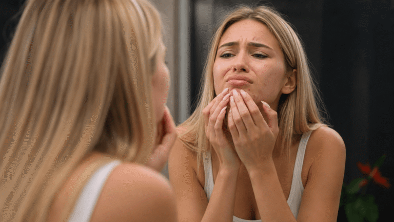 7 astuces pour camoufler un bouton avant un événement sans l'aggraver